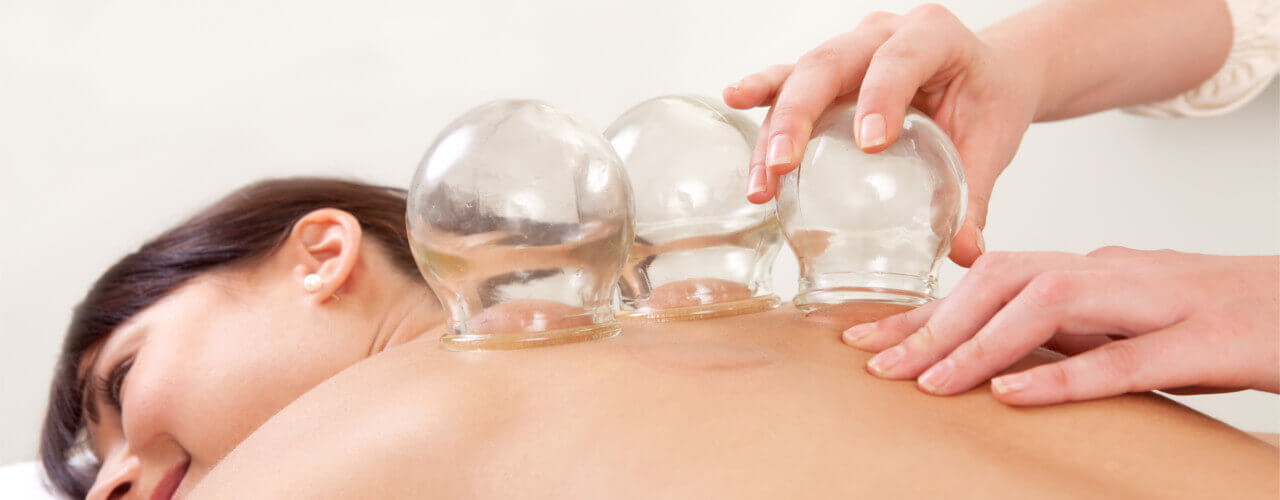 Cupping Therapy Frisco, McKinney, Allen, and Plano, TX