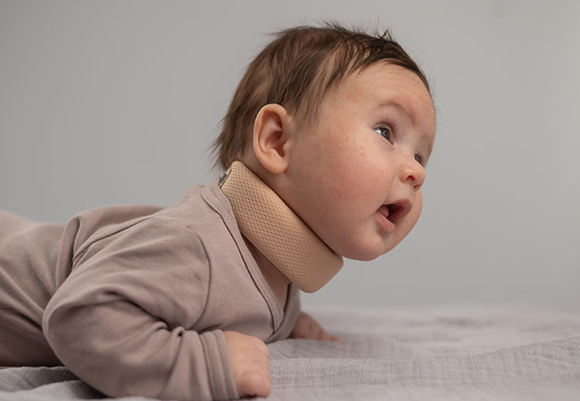 Straightening the Course: Treating Torticollis with Pediatric Physical Therapy